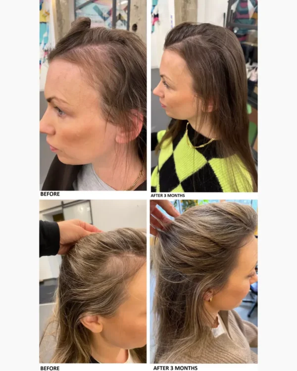 HAAR Nordic Botanical Growth Anti Hair-Loss – før og etter 3 måneder